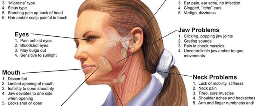 Diagnosing Tmj Disorder Headache Tmj Los Angeles Pain Clinic